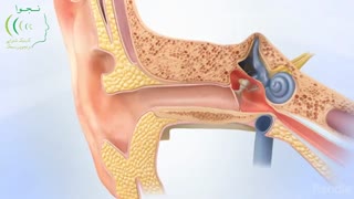 کم شنوایی انتقالی