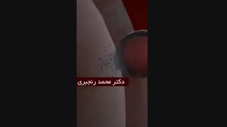 مسیر اسپرم ها برای رسیدن به تخمک