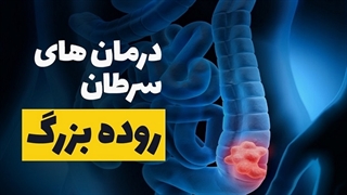 بررسی درمان های سرطان روده بزرگ