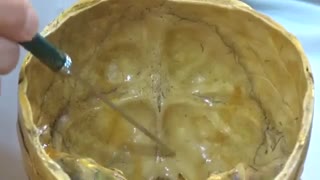 Persian Anatomy, Head & Neck آناتومی سر و گردن بزبان فارسی Occipital bone