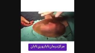 حرکات جنین در بارداری
