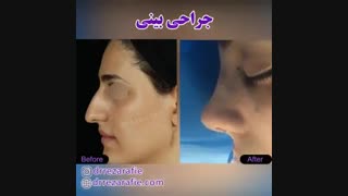 جراحی زیبایی بینی | دکتر رفیع