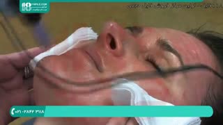 آموزش میکرونیدلینگ | آموزش میکرودرم