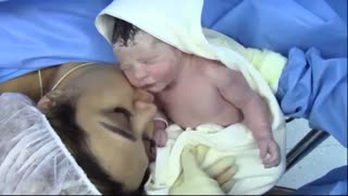 فیلم زایمان سزارین بدون سانسور