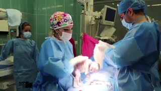 عمل زایمان سزارین