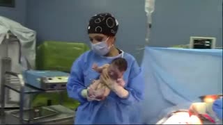 جراحی سزارین در تهران