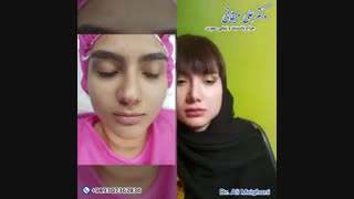 فیلم جراحی زیبایی بینی