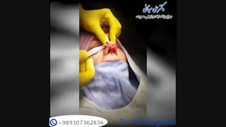 فیلم عمل جراحی بینی