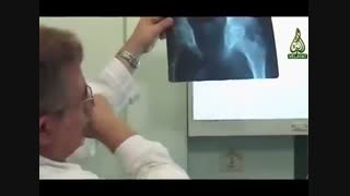 شفای بیماری لاعلاج نوجوان سنی توسط امام زمان(ع)