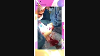 سزارین توسط دکتر مهتاب مرجانی