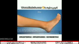 لیزر موی فیلیپس | 09120750932 | از بین بردن موهای زائد | بهترین مرکز لیزر | هزینه لیزر کل بدن | لیزر موهای صورت لیزر مو