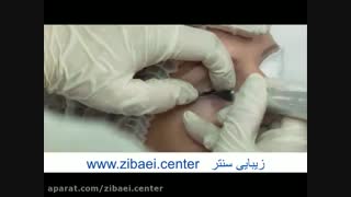 آموزش میکروپیگمنتیشن چشم - فیلم خالکوبی خط چشم