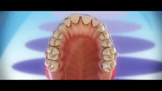 ارتودنسی ثابت-مرکز فوق تخصصی ایمپلنت وزیبایی پردیس