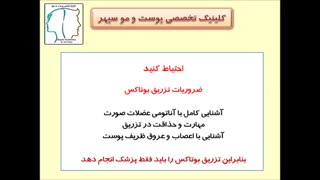 بوتاکس