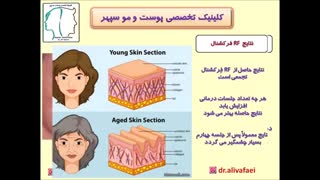 RF فرکشنال سوزنی