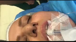 فیلم عمل جراحی بینی گوشتی