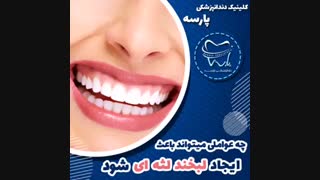 عوامل ایجاد لبخند لثه ای