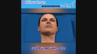 انیمیشن لیفت صورت و گردن
