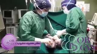 فیلم عمل جراحی زایمان سزارین