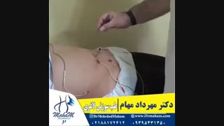 طب سوزنی و لاغری