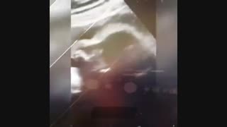 جنین زیبای ۳۱ هفته