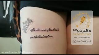 قیمت تاتو بدن | 