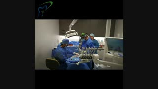 ایمپلنت دندان