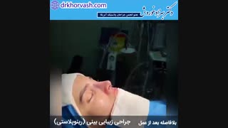 فیلم جراحی زیبایی بینی