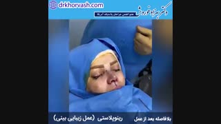 فیلم عمل زیبایی بینی