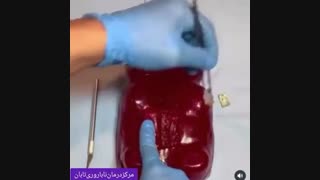ویدئو شماتیک و جذاب زایمان سزارین