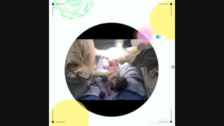 زایمان سزارین ازشروع تا پایان