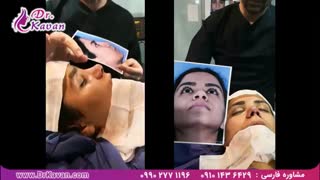 عمل زیبایی بینی