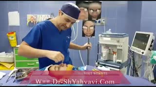 نتیجه جراحی بینی | دکتر شهریار یحیوی
