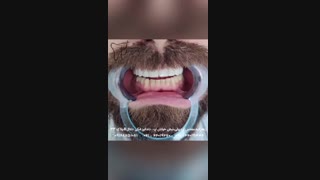 اجرای ۱۱واحد لمینت نچرال