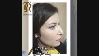 فیلم بدون سانسور جراحی پلک