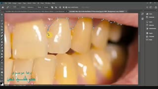 آموزش فتوشاپ  روش سفید کردن دندان-Mixkade.ir