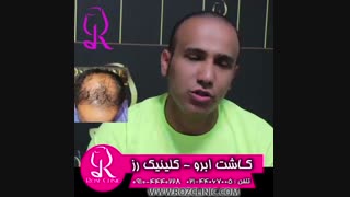 فیلم کاشت مو | کلینیک رز | 09104440228 | شماره 74