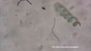 تصویر میکروسکوپی جلبک اسپیرولیناArthrospira platensis under microscope.