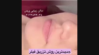 جدیدترین روش تزریق فیلر در سالن زیبایی پریس