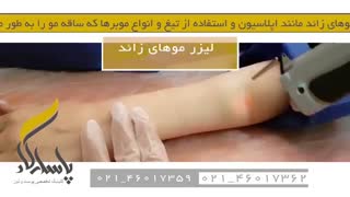 لیزر موهای زائد