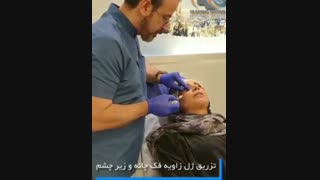 تزریق ژل برای زایه سازی فک و گودی زیر چشم