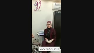 درمان ترک های پوستی با کربوکسی تراپی دندانپزشکی کودکان
