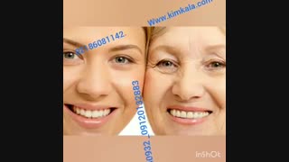 بهترین کرم کلاژن سازی پوست | 09120750932 | کرم کلاژن سازی قوی