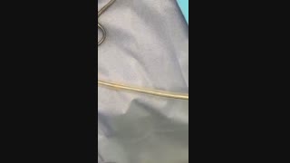 فیلم بدون سانسور لیپوماتیک شکم و پهلو به همراه ابدومینوپلاستی