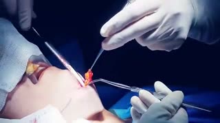 Double chin deformity | دکتر شهریار یحیوی