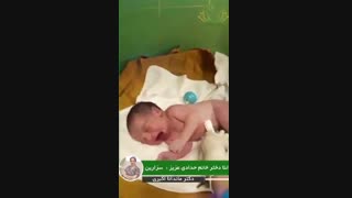 فیلم تولد دختر بسیار زیبا در زایمان سزارین