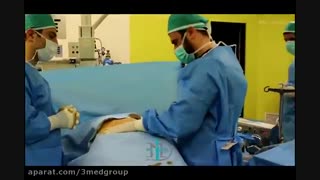 دستگاه LIPO MODELING