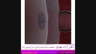 فیلم رشد تخمک و تشکیل جنین