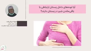 پاسخ به برخی سوالات پر تکرار در مورد پستان