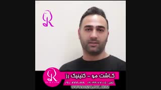 فیلم کاشت مو | کلینیک رز | 09104440228 | شماره 76
